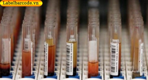 lợi ích khi sử dụng máy quét mã vạch kiểm kê hàng hóa